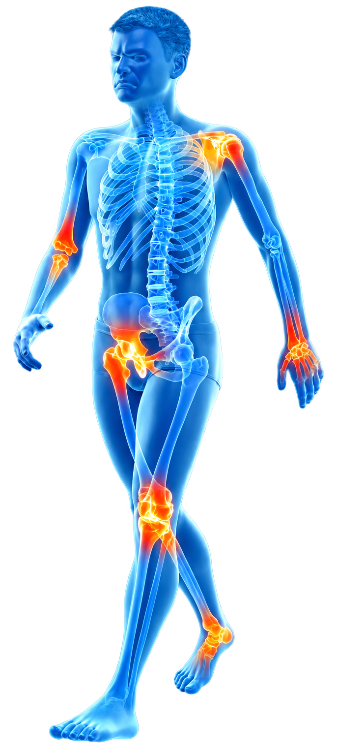 Anatomical figure with joint pain highlighted